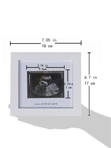 Baby Sonogram Photo Frame - 1st Ultrasound Picture Frame - 7x7 displays 4x3