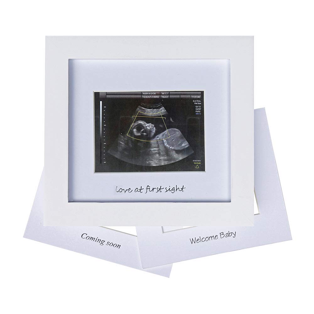 Baby Sonogram Photo Frame - 1st Ultrasound Picture Frame - 7x7 displays 4x3