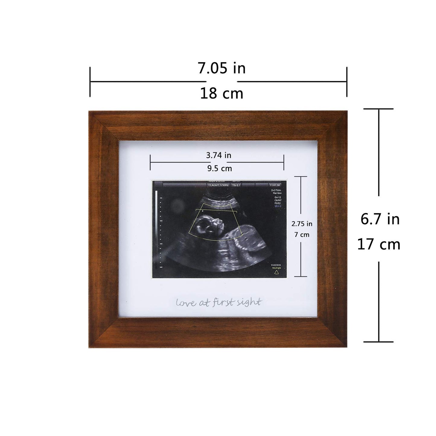 Baby Sonogram Photo Frame - 1st Ultrasound Picture Frame - 7x7 displays 4x3