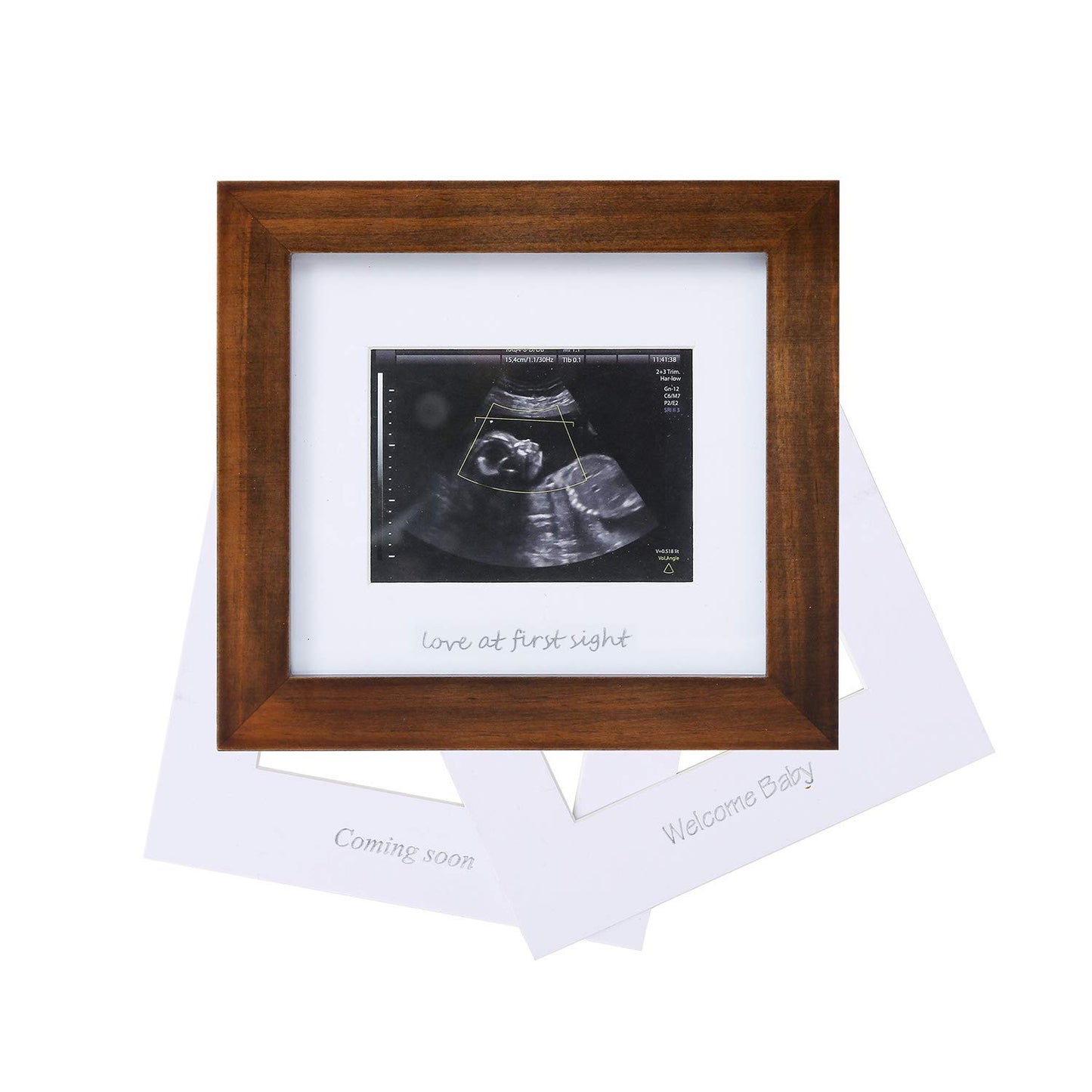 Baby Sonogram Photo Frame - 1st Ultrasound Picture Frame - 7x7 displays 4x3