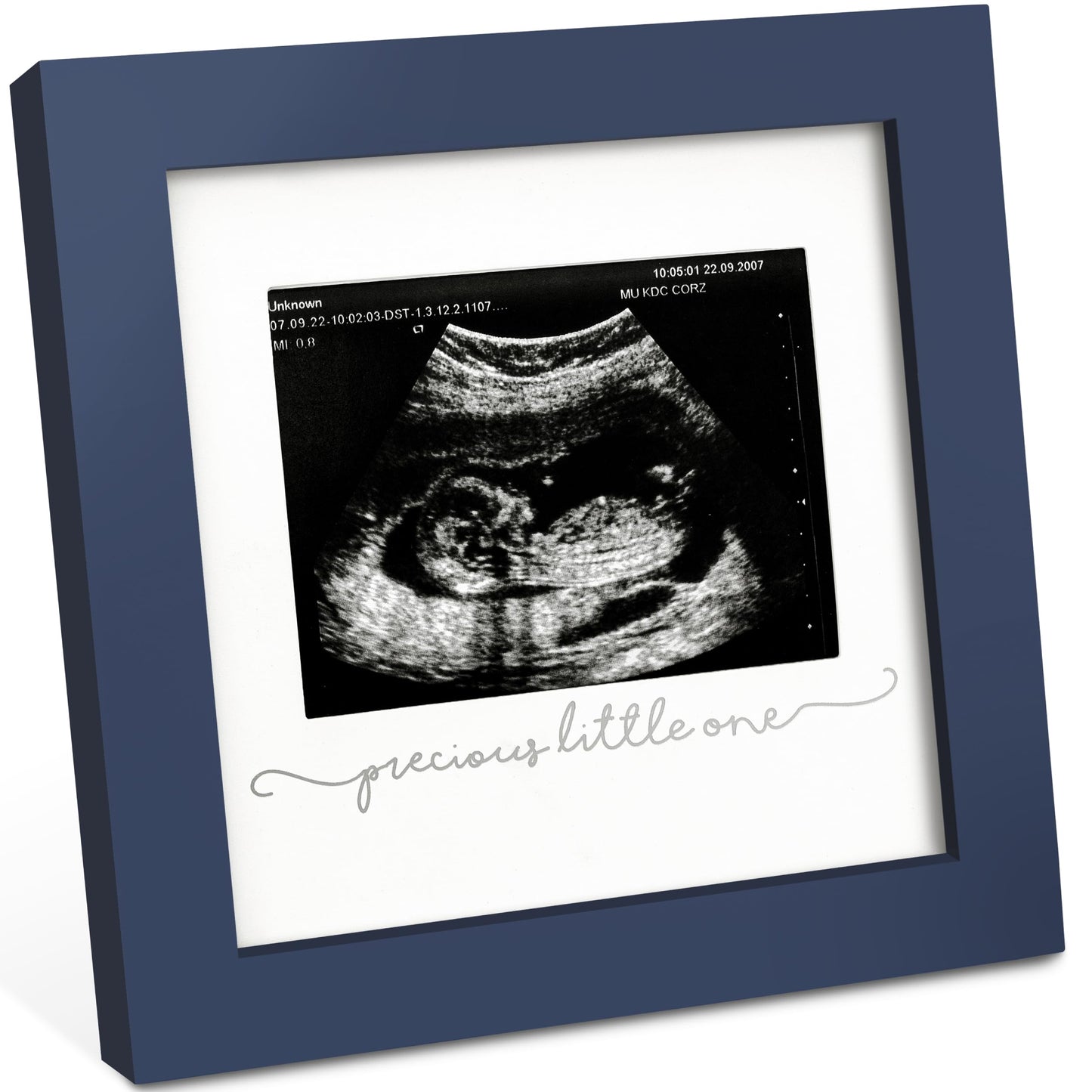 Baby Sonogram Picture Frame - Modern Ultrasound Frame for Mom to Be - Pregnancy Announcement Sonogram Photo Frames