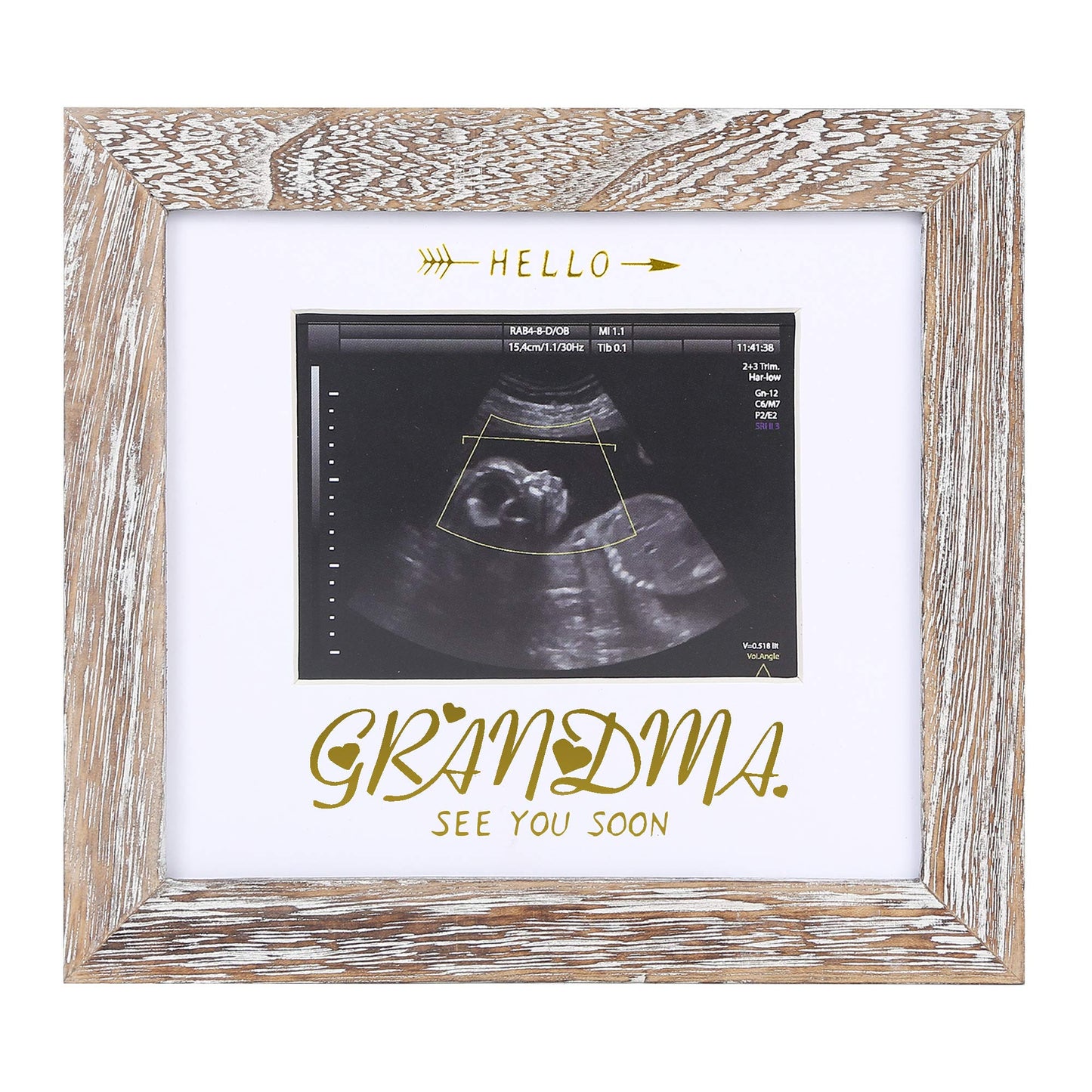 Baby Sonogram Photo Frame - 1st Ultrasound Picture Frame - 7x7 displays 4x3