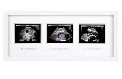 Triple Baby Sonogram Pregnancy Frame White Holds Three 4x6 Photos